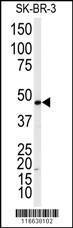 Anti-ADRB2 Rabbit Polyclonal Antibody (Biotin)