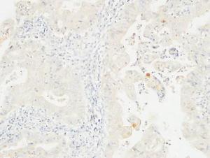 Immunohistochemical analysis of paraffin-embedded human colon using Anti-14-3-3 sigma Antibody