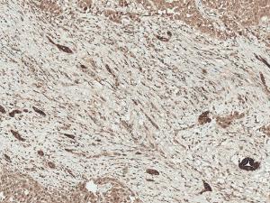 Immunohistochemistry analysis of human liver, fixed in formalin and paraffin-embedded. The Primary Antibody used was Anti-LRP1 Antibody (A305059) at 1:50 for 30 minutes at room temperature. Counterstain: Hematoxylin. Magnification: 10X. HRP-DAB Detection