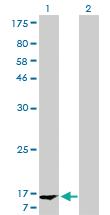 Anti-FABP1 Mouse Monoclonal Antibody [clone: 5F7]