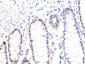 Immunohistochemistry analysis of paraffin-embedded human colon tissue using Anti-DKC1 / Dyskerin Antibody [ARC1063] (A309088) at a dilution of 1:100 (40x lens). Perform microwave antigen retrieval with 10 mM PBS buffer pH 7.2 before commencing with IHC staining protocol.