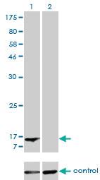 Anti-FABP1 Mouse Monoclonal Antibody [clone: 5F7]