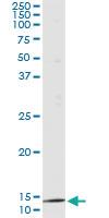 Anti-PTH Mouse Monoclonal Antibody [clone: 4C12]