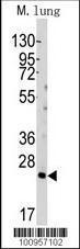 Anti-BID Rabbit Polyclonal Antibody (FITC (Fluorescein Isothiocyanate))