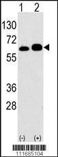 Anti-RPS6KB1 Rabbit Polyclonal Antibody (AP (Alkaline Phosphatase))