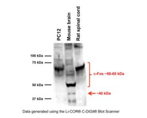 Western blot analysis of c-Fos expression in PC12 cell lysates (Lane 1, 20 μg), mouse brain (Lane 2, 50 μg) and rat spinal cord homogenate (Lane 3, 50 μg).