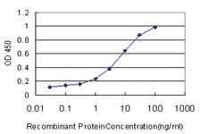 Anti-FABP1 Mouse Monoclonal Antibody [clone: 5F7]