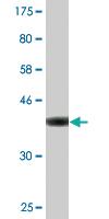 Anti-PIK3C2A Mouse Monoclonal Antibody [clone: 3E7]