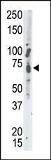 Anti-PTPN9 Rabbit Polyclonal Antibody (Biotin)