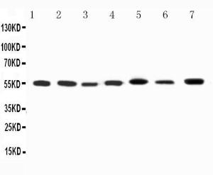 Anti-Kv1.1 potassium channel Rabbit Antibody