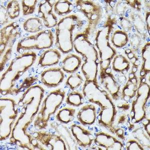 Immunohistochemistry analysis of paraffin-embedded mouse kidney using Anti-VDAC3 Antibody (A8647) at a dilution of 1:20 (40X lens). Perform high pressure antigen retrieval with 10 mM citrate buffer pH 6.0 before commencing with IHC staining protocol