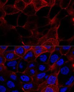 Confocal immunofluorescence analysis of A431 cells using Anti-CD44 Antibody (A93018) at a dilution of 1:200 DAPI was used to stain the cell nuclei (blue)