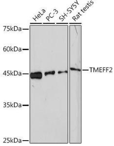 Anti-TMEFF2 antibody