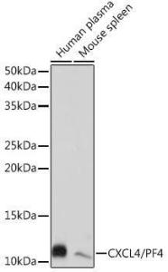 Western blot analysis of extracts of various cell lines, using Anti-PF4 Antibody [ARC2076] (A307846) at 1:1000 dilution. The secondary Antibody was Goat Anti-Rabbit IgG H&L Antibody (HRP) at 1:10000 dilution. Lysates/proteins were present at 25 µg per lane