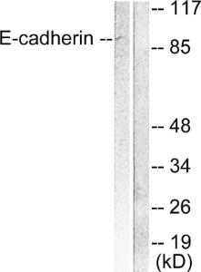 Anti-pan Cadherin Rabbit Polyclonal Antibody