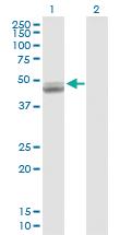 Anti-UQCRC1 Rabbit Polyclonal Antibody