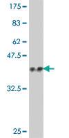 Anti-PHF21A Mouse Polyclonal Antibody