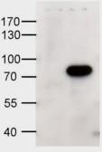 Anti-ABCD1 Goat Polyclonal Antibody