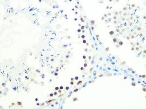 Immunohistochemistry analysis of paraffin-embedded mouse testis using Anti-DKC1 / Dyskerin Antibody [ARC1063] (A309088) at a dilution of 1:100 (40x lens). Perform microwave antigen retrieval with 10 mM PBS buffer pH 7.2 before commencing with IHC staining protocol.