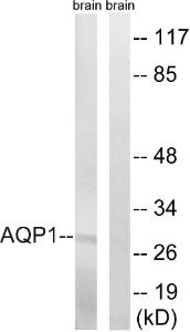 Western blot analysis of lysates from rat brain cells using Anti-AQP1 Antibody. The right hand lane represents a negative control, where the Antibody is blocked by the immunising peptide