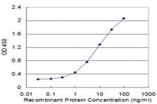 Anti-FABP1 Mouse Monoclonal Antibody [clone: 5E7]