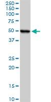 Anti-UQCRC1 Rabbit Polyclonal Antibody