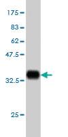 Anti-AKT3 Mouse Monoclonal Antibody [clone: 2F3]