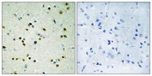 Immunohistochemical analysis of paraffin-embedded human brain using Anti-JHD3B Antibody. The right hand panel represents a negative control, where the antibody was pre-incubated with the immunising peptide