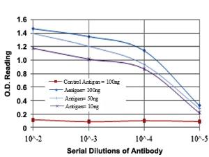 Anti-MAP3K5 Mouse Monoclonal Antibody [clone: 2E4]