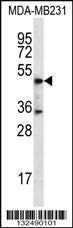 Anti-DSN1 Rabbit Polyclonal Antibody (HRP (Horseradish Peroxidase))