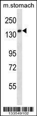 Anti-UBN2 Rabbit Polyclonal Antibody