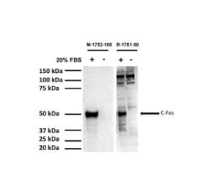 Western blot analysis of c-Fos expression in rat C6 cells (40 µg lysate loading per lane). C6 cells were serum-starved for 20 hours and then stimµlated with 20% FBS for 2 hrs (+). Control cells were left in serum-depleted cµlture medium (-).