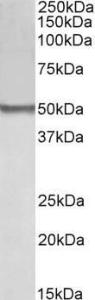 Anti-BLK Antibody (A84940) (0.1 µg/ml) staining of Human Thymus lysate (35 µg protein in RIPA buffer). Detected by chemiluminescence