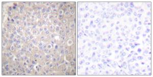 Anti-pan Cadherin Rabbit Polyclonal Antibody