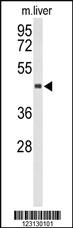 Anti-CHIA Rabbit Polyclonal Antibody