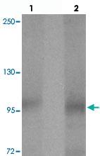 Anti-PTCHD2 Rabbit Polyclonal Antibody