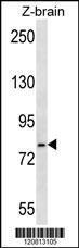 Anti-HSPA5 Rabbit Polyclonal Antibody (AP (Alkaline Phosphatase))