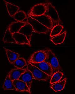 Confocal immunofluorescence analysis of HeLa cells using Anti-CD44 Antibody (A93018) at a dilution of 1:100 DAPI was used to stain the cell nuclei (blue)