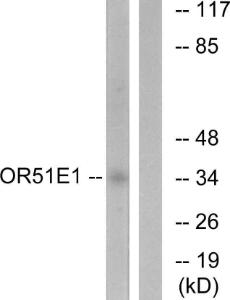 Western blot analysis of lysates from HeLa cells using Anti-OR51E1 Antibody. The right hand lane represents a negative control, where the antibody is blocked by the immunising peptide.