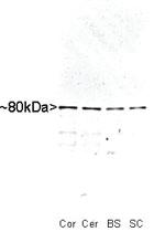 Anti-MARCKS Polyclonal Antibody