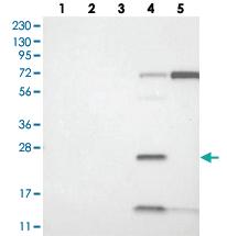 Anti-HSD17B13 Rabbit Polyclonal Antibody