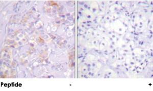 Anti-ZAP70 Rabbit Polyclonal Antibody