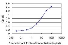 Anti-TSSK3 Mouse Monoclonal Antibody [clone: 3E6]