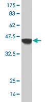 Anti-SLC22A4 Mouse Polyclonal Antibody