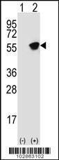 Anti-GFAP Rabbit Polyclonal Antibody (APC (Allophycocyanin))