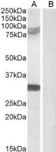 Anti-TRIM2 Goat Polyclonal Antibody