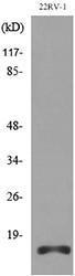 Western blot analysis of lysate from 22RV 1 cells using Anti-APLN Antibody