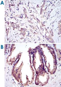 Anti-MAP3K5 Mouse Monoclonal Antibody [clone: 2E4]