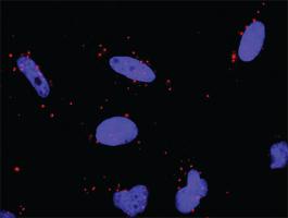 Anti-HSPA1L + TP53 Antibody Pair