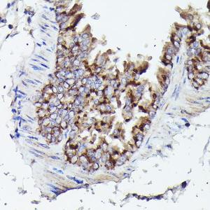 Immunohistochemistry analysis of paraffin-embedded mouse lung using Anti-VDAC3 Antibody (A8647) at a dilution of 1:20 (40X lens). Perform high pressure antigen retrieval with 10 mM citrate buffer pH 6.0 before commencing with IHC staining protocol